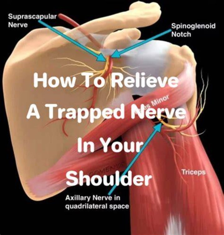 Can you exercise with a trapped nerve in shoulder?