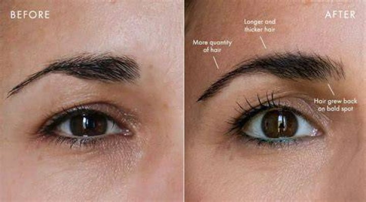 Do eyebrow piercings stop hair growth?