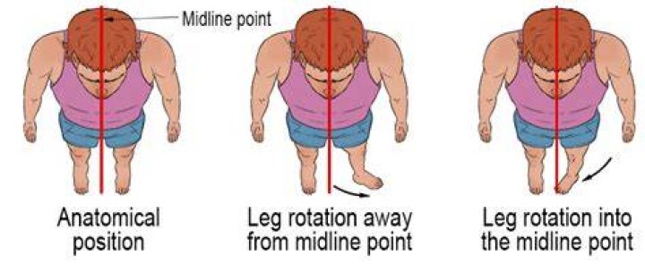 Is motion toward the midline?