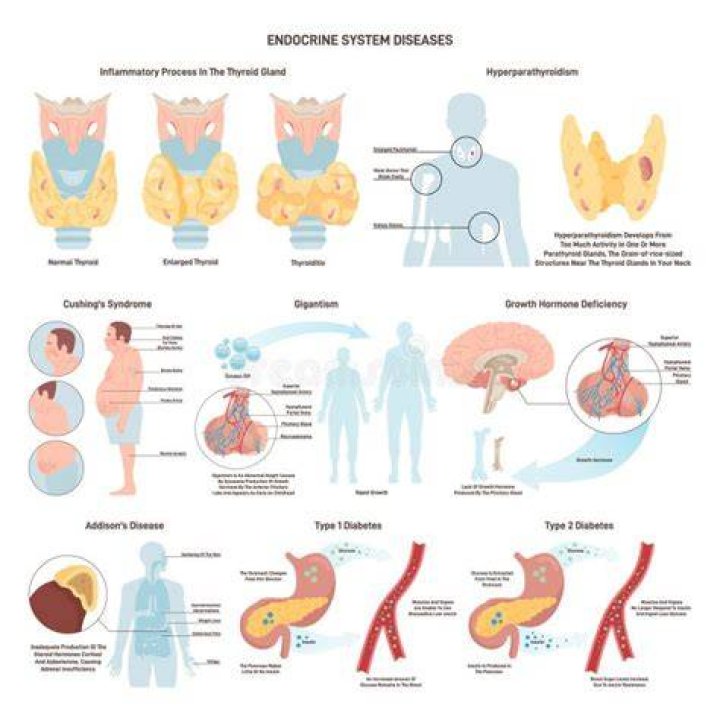 What are some diseases of the endocrine system?